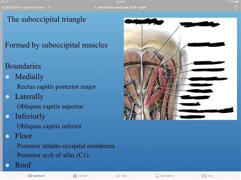 Suboccipital Triangle Diagram | Quizlet