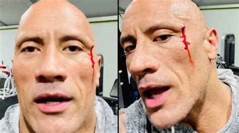 Dwayne Johnson injures face while working out - The Samikhsya