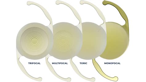 Carolinas Centers For Sight, P.C. - Choosing the Right Cataract Lens