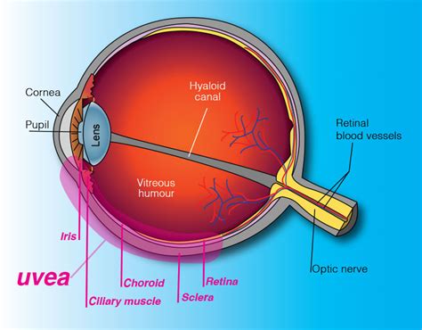 Uveitis | Rand Eye Institute