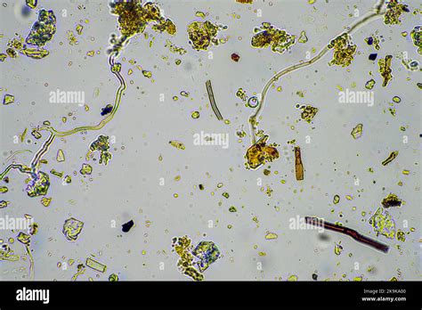 soil sample under the microscope. soil fungi and microorganisms cycling ...