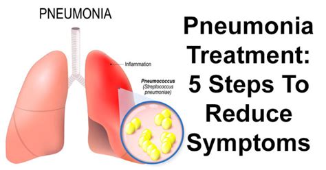 Pneumonia Treatment: 5 Steps To Reduce Symptoms - David Avocado Wolfe