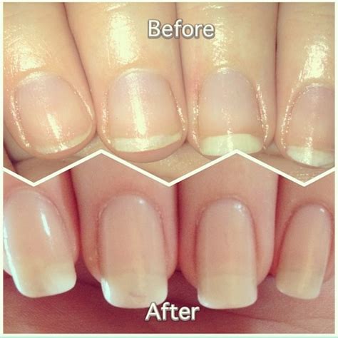 Before and After nail growth! | Amymay W.'s (AmyFley) Photo | Beautylish