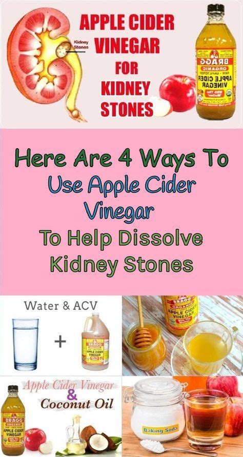 Here Are 4 Ways To Use Apple Cider Vinegar To Help Dissolve Kidney Stones – Organic Life Ideas ...