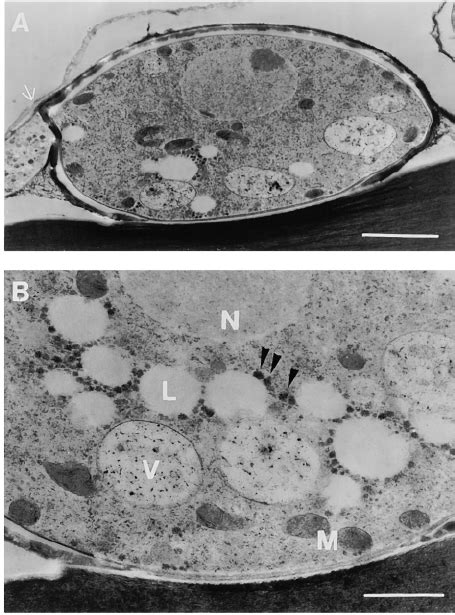 Ultrastructure of an Appressorium of M. grisea . | Download Scientific ...