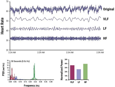 Heart Rate Variability