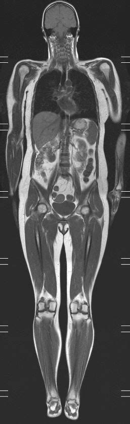 Whole Body Screening with MRI - Desert Health®