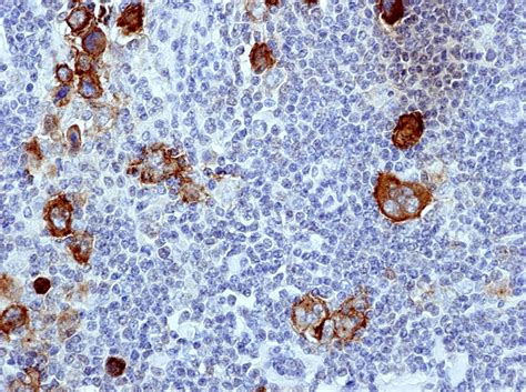 CD30 Polyclonal Antibody