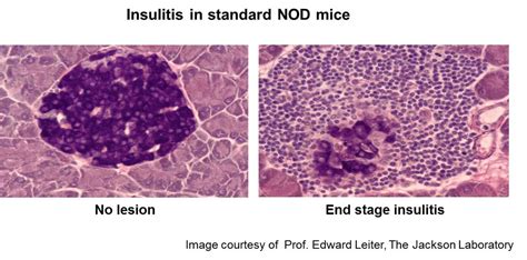 The ‘skinny’ on non-diabetic controls for non-obese diabetic (NOD) mice