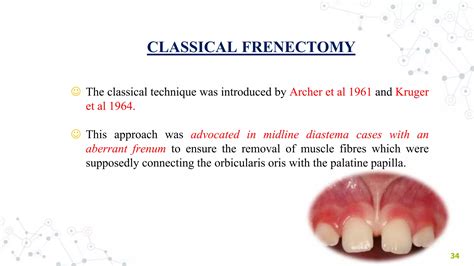 FRENAL ATTACHMENT & ITS MANAGEMENT | PPT