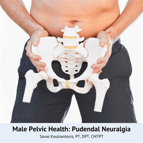 Male Pelvic Health: Pudendal Neuralgia