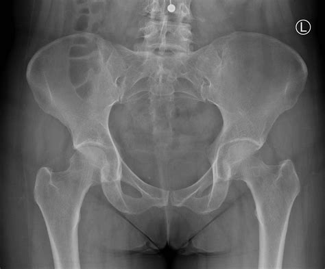 Diagnostics: Knee and Ankle X-rays — Taming the SRU