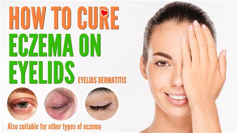 How to cure eczema on eyelids | Eyelids Dermatitis treatment and natural home remedies 2021 ...