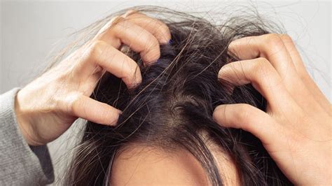 How to Get Dried Blood Out Of Your Hair?