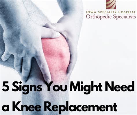 Signs You Need Joint Replacement Surgery