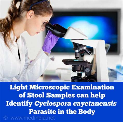 Cyclospora Infection | Cyclosporiasis - Causes, Symptoms, Diagnosis ...