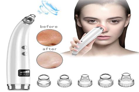 Blackhead Vacuum Cleaner – About, Working, Types and More