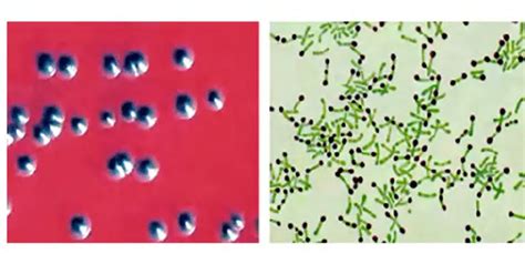 Corynebacterium diphtheriae: Pathogenesis, Lab Diagnosis