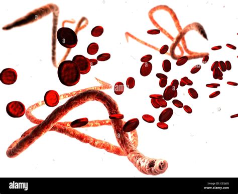 Ebola virus, Microscopic view Stock Photo - Alamy