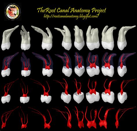 The Root Canal Anatomy Project: Maxillary Second Molar