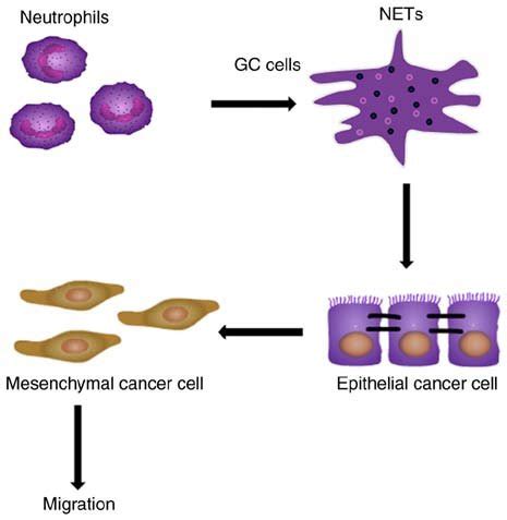 Schematic illustration of the role of NETs in promoting EMT in tumor ...