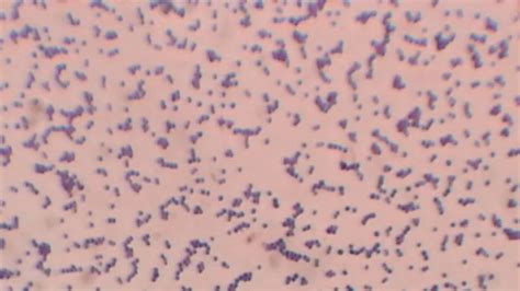 Gram Positive Cocci In Pairs And Chains