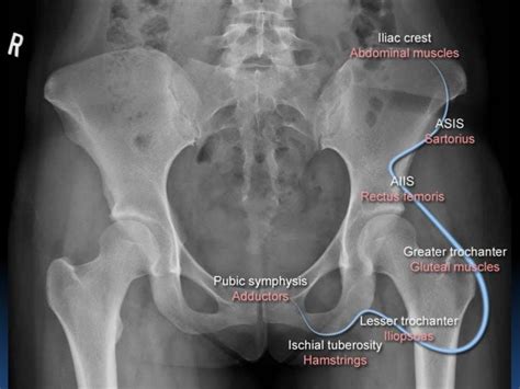 Radiographic MSK Anatomy