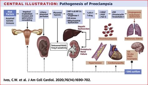 Preeclampsia—Pathophysiology and Clinical Presentations: JACC State-of-the-Art Review | Journal ...