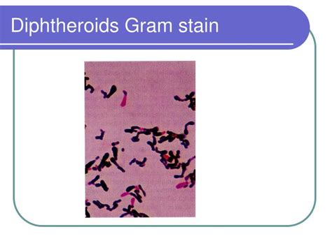 PPT - Corynebacterium PowerPoint Presentation - ID:201783