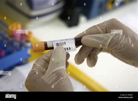 Pathologist labeling blood samples in test tube Stock Photo - Alamy