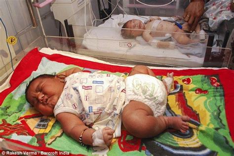 Biggest baby ever born in India is a massive 13lb | How big is baby, Baby, Newborn baby