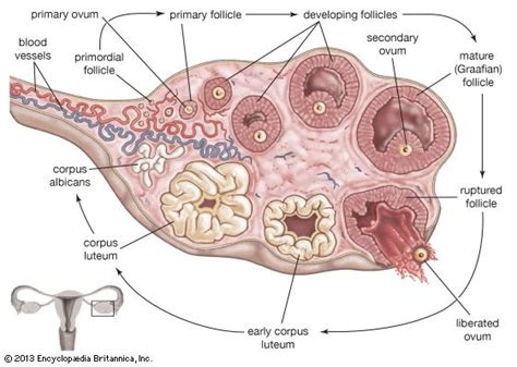 Stein-Leventhal syndrome | Stein-Leventhal Syndrome, Causes & Treatment ...