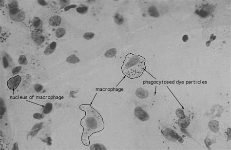 HLS [ Connective Tissue, macrophages] HIGH MAG labeled