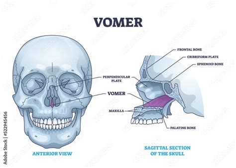 Vomer bone with facial skeleton and frontal nasal cavity outline ...