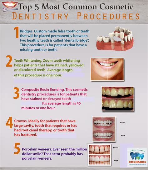 #ODC_fact Here are some common dental procedures that would help you ...