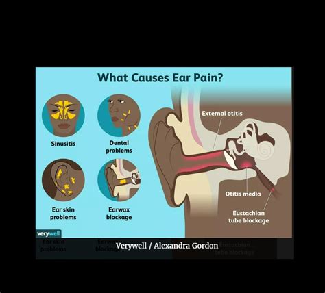 Causes of Ear Pain and Treatment Options - FrontlineER Dallas