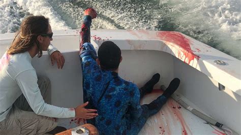 Diver attacked by shark rescued by fishing boat full of nurses in ...