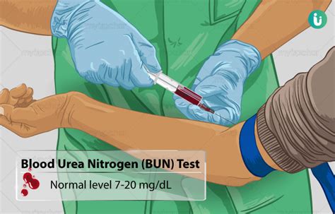 Blood Urea Nitrogen (BUN) Test: Procedure, Purpose, Results, Normal range, Cost, Price, Online ...