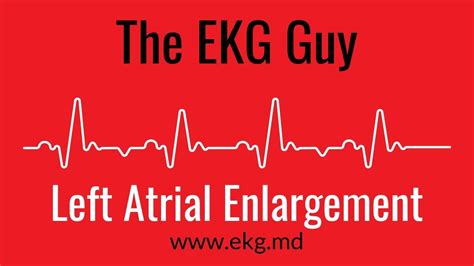 Left Atrial Enlargement EKG l The EKG Guy - www.ekg.md - YouTube