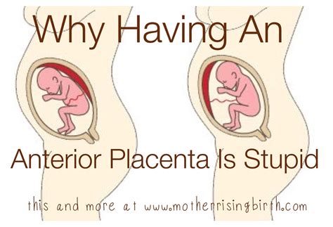 Is an Anterior Placenta Bad for Pregnancy and Birth? | Anterior placenta, Placenta, Pregnancy birth