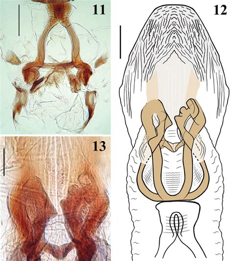 Hiranetis atra Stål, male genitalia, dorsal view. 11 articulatory ...