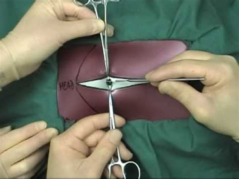 Abdominal incision - YouTube