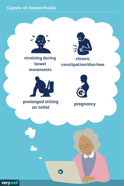 Hemorrhoids: Causes and Risk Factors