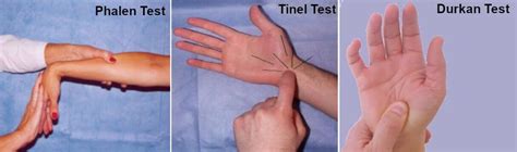 Test for Carpal Tunnel Syndrome