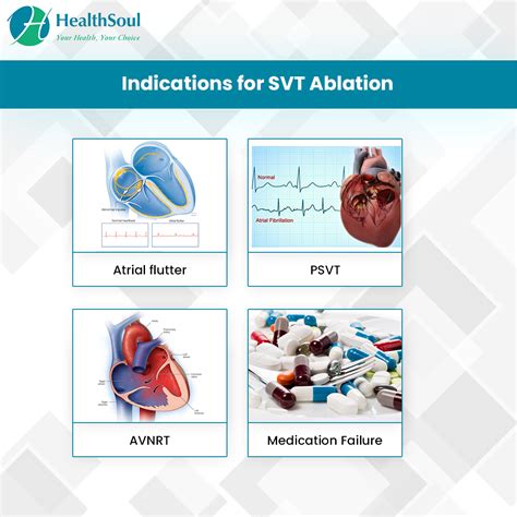 Supraventricular Tachycardia Ablation: Indications and Complications – Healthsoul