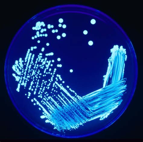 How to control Legionella pneumophila – Deadly Bacteria Visits American Convention- Legionella ...