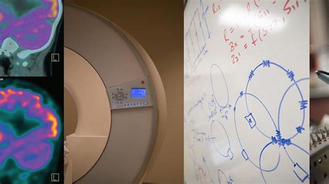 Radiology & Imaging Sciences Department | U of U School of Medicine