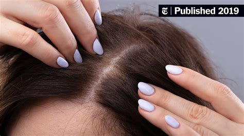 Getting to the Root of Hair Loss - The New York Times