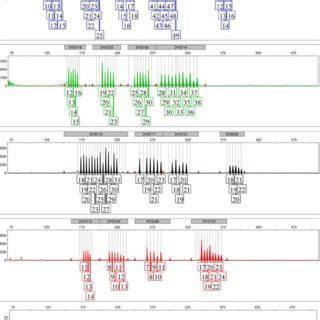 Representative electropherogram of DNA mixture. a Formed by 2800 M... | Download Scientific Diagram