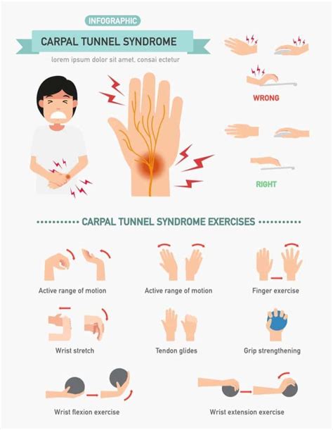 Carpal Tunnel Syndrome (CTS) Hand and Wrist Exercises | rsi | Carpal tunnel exercises, Carpal ...